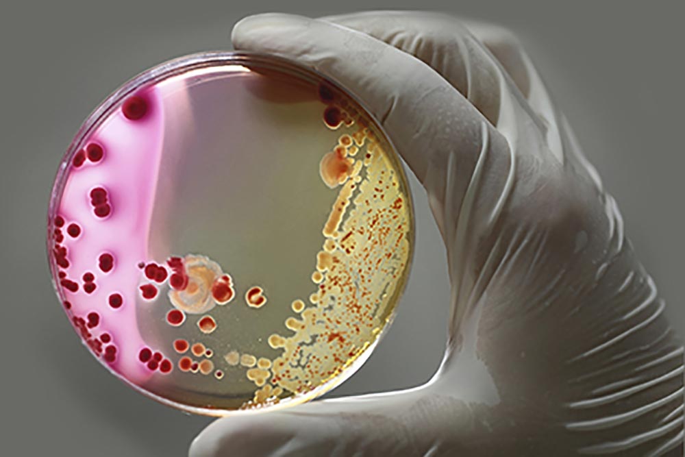 antibiotiki_in_rezistenca